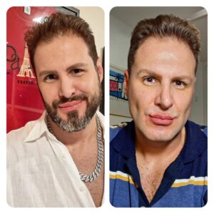 Bernardo Langlott retira a barba e levanta debate sobre o gay padrão: “o padrão é você quem faz’’